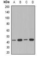 ACAA1 Rabbit Polyclonal Antibody