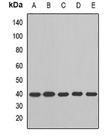 BCAT2 Rabbit Polyclonal Antibody