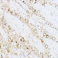 BCAT2 Rabbit Polyclonal Antibody