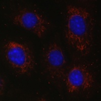 BCAT2 Rabbit Polyclonal Antibody