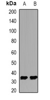 Ketohexokinase Rabbit Polyclonal Antibody