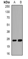 WISP2 Rabbit Polyclonal Antibody