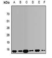 VAMP3 Rabbit Polyclonal Antibody