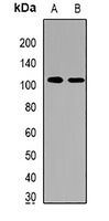 HRP2 Rabbit Polyclonal Antibody