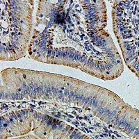 GLUD1 Rabbit Polyclonal Antibody