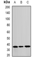 ANXA8L2 Rabbit Polyclonal Antibody
