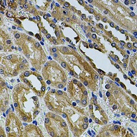 ANXA8L2 Rabbit Polyclonal Antibody