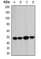 BCS1L Rabbit Polyclonal Antibody