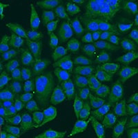 BCS1L Rabbit Polyclonal Antibody