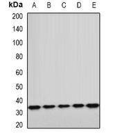 ETFA Rabbit Polyclonal Antibody
