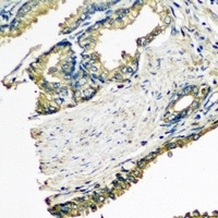 ETFA Rabbit Polyclonal Antibody