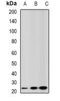 GSTA2 Rabbit Polyclonal Antibody