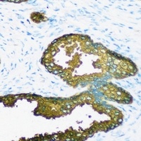 GSTA2 Rabbit Polyclonal Antibody