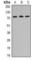 HSPA6 Rabbit Polyclonal Antibody