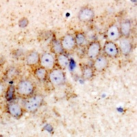 HSPA6 Rabbit Polyclonal Antibody