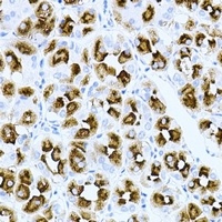 Rac 1 Rabbit Polyclonal Antibody