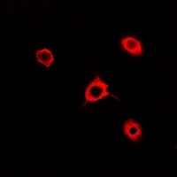 Rac 1 Rabbit Polyclonal Antibody
