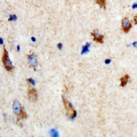 SHMT1 Rabbit Polyclonal Antibody