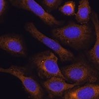 SHMT1 Rabbit Polyclonal Antibody