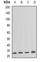 NAT8 Rabbit Polyclonal Antibody