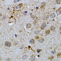 NAT8 Rabbit Polyclonal Antibody