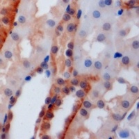 PSTPIP1 Antibody