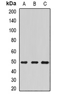 ECSIT Rabbit Polyclonal Antibody