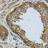 CHRFAM7A Rabbit Polyclonal Antibody