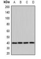 ACAT2 Rabbit Polyclonal Antibody