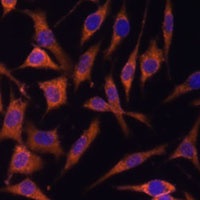 ACAT2 Rabbit Polyclonal Antibody