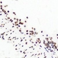 NSD2 Rabbit Polyclonal Antibody