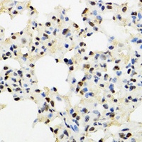KDM4A Rabbit Polyclonal Antibody