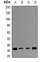 ERP29 Rabbit Polyclonal Antibody