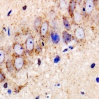 USP25 Rabbit Polyclonal Antibody