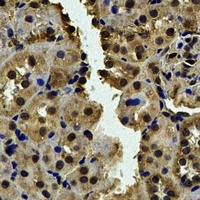 CALCOCO1 Rabbit Polyclonal Antibody