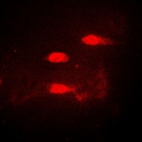 CALCOCO1 Rabbit Polyclonal Antibody