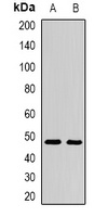 AMY2A Rabbit Polyclonal Antibody