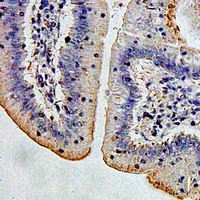 AMY2A Rabbit Polyclonal Antibody