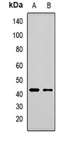 MBNL1 Rabbit Polyclonal Antibody