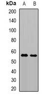 TRMT61B Rabbit Polyclonal Antibody
