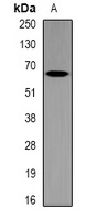 MT-ND5 Rabbit Polyclonal Antibody