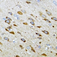 MT-ND5 Rabbit Polyclonal Antibody