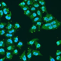 THOC1 Rabbit Polyclonal Antibody