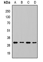 CHMP1B Rabbit Polyclonal Antibody
