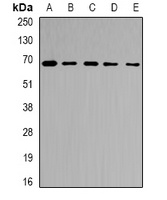 Ribophorin-2 Antibody