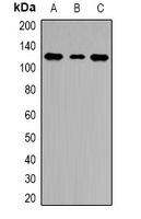 HLTF Rabbit Polyclonal Antibody