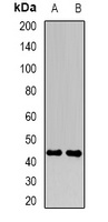 FBXO22 Rabbit Polyclonal Antibody