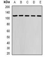 DHTKD1 Rabbit Polyclonal Antibody