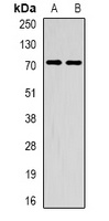 METTL3 Rabbit Polyclonal Antibody
