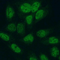 METTL3 Rabbit Polyclonal Antibody